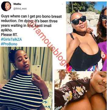 Read The Shocking Story Of Lady Struggling To Live With Her Heavy Breasts (Photos)